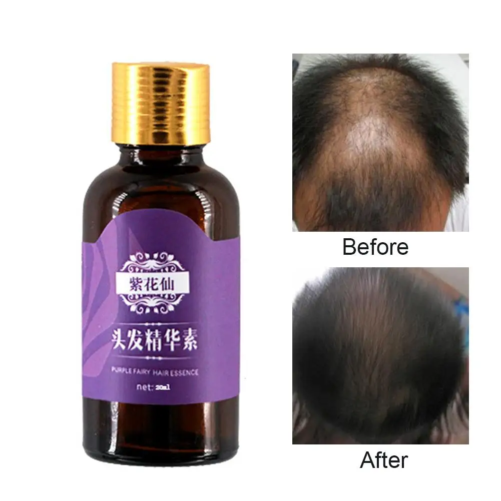 

40# 2019 Unisex 30ml Hair Growth Serum Anti Loss Moisturizing Scalp Treatment Essential Oil Health Care Scalp Treatment