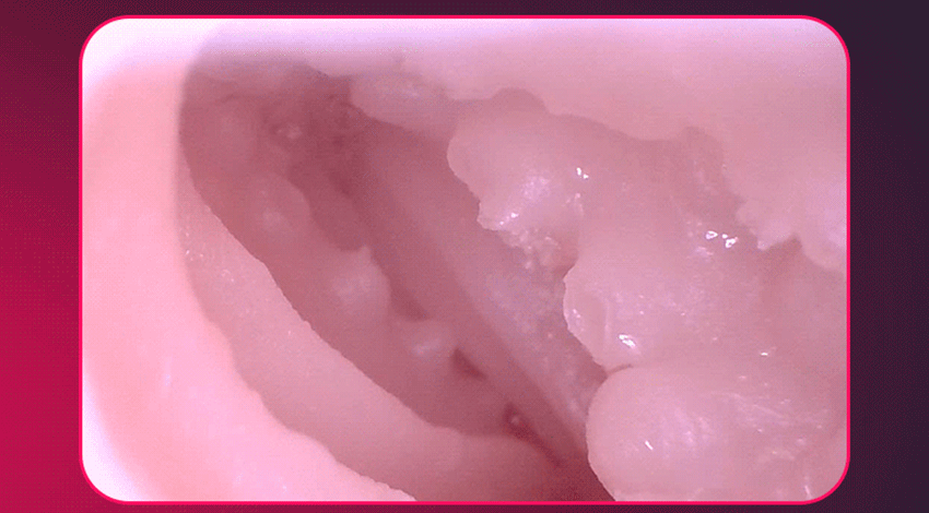 male masturbator (8)