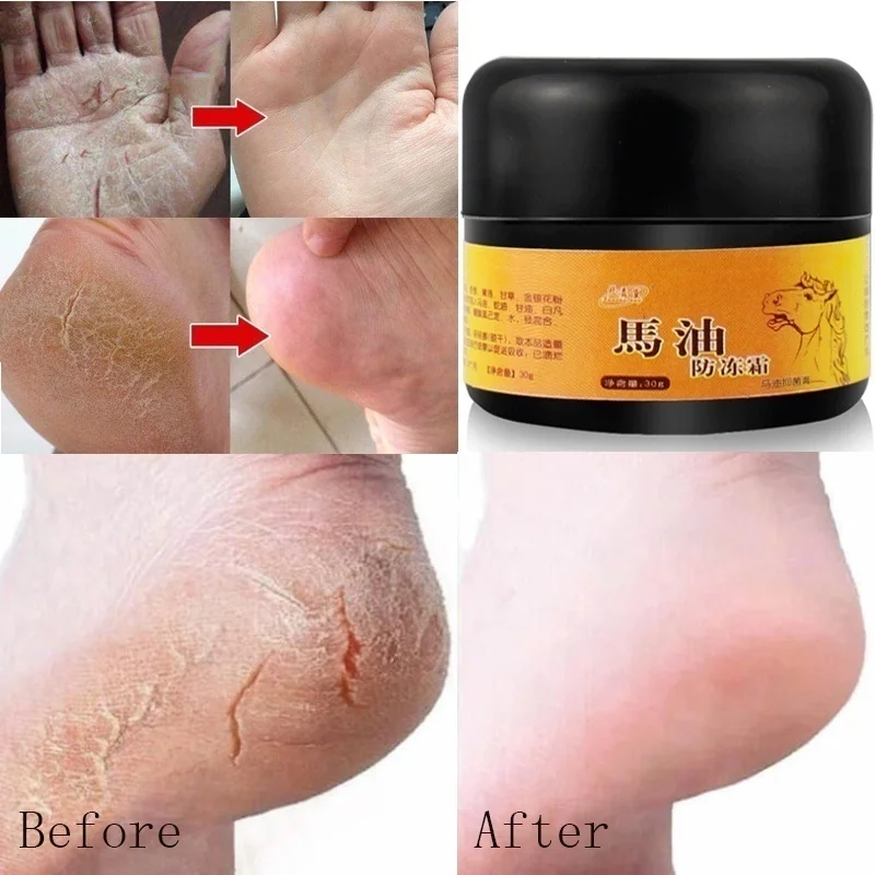 16-5c88687c2a29df5a247162df-15-original