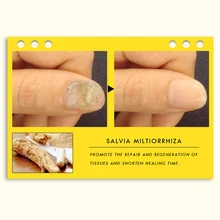 Женьшень ногтей противогрибковая лечение травяной крем удаление грибка носок анти-инфекция Уход за ногами мазь TY99