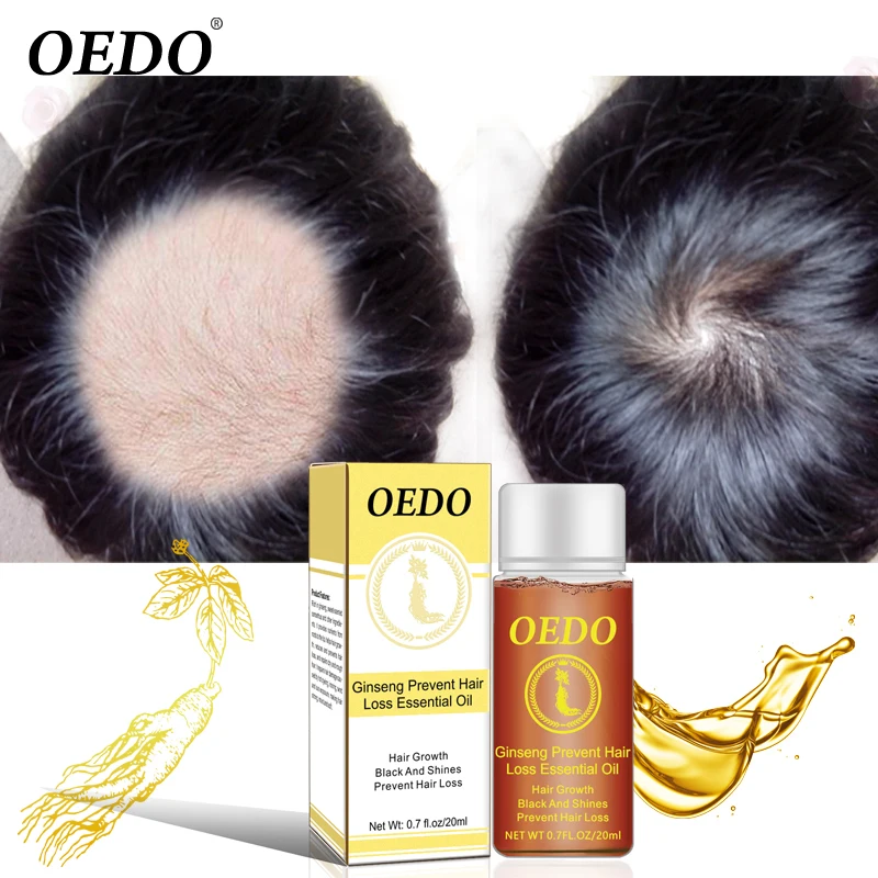 

OEDO Ginseng Hair Care Essential Oil Repairs Hair Damage Making Hair Strong Moist Soft Multi-functional Hair Scalp Treatments
