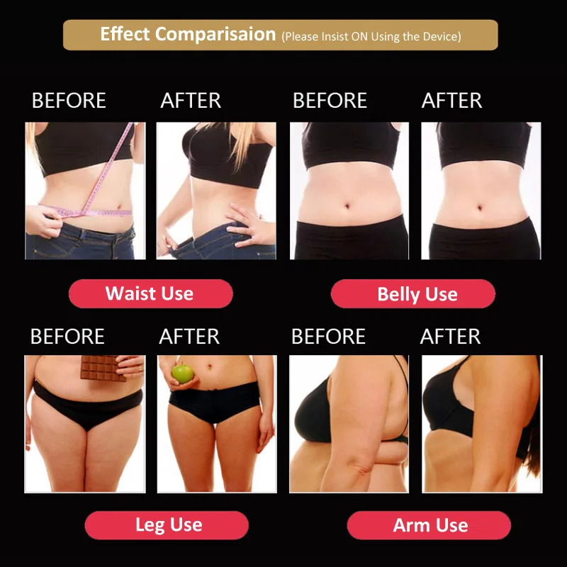 CV rf body slimming machine 41