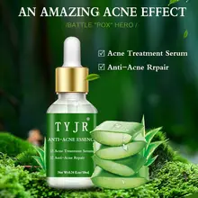 10 мл Алоэ Вера эссенция для удаления акне увлажняющее увлажнение контроль масла ремонт уход за кожей Лечение Уход за кожей аксессуар