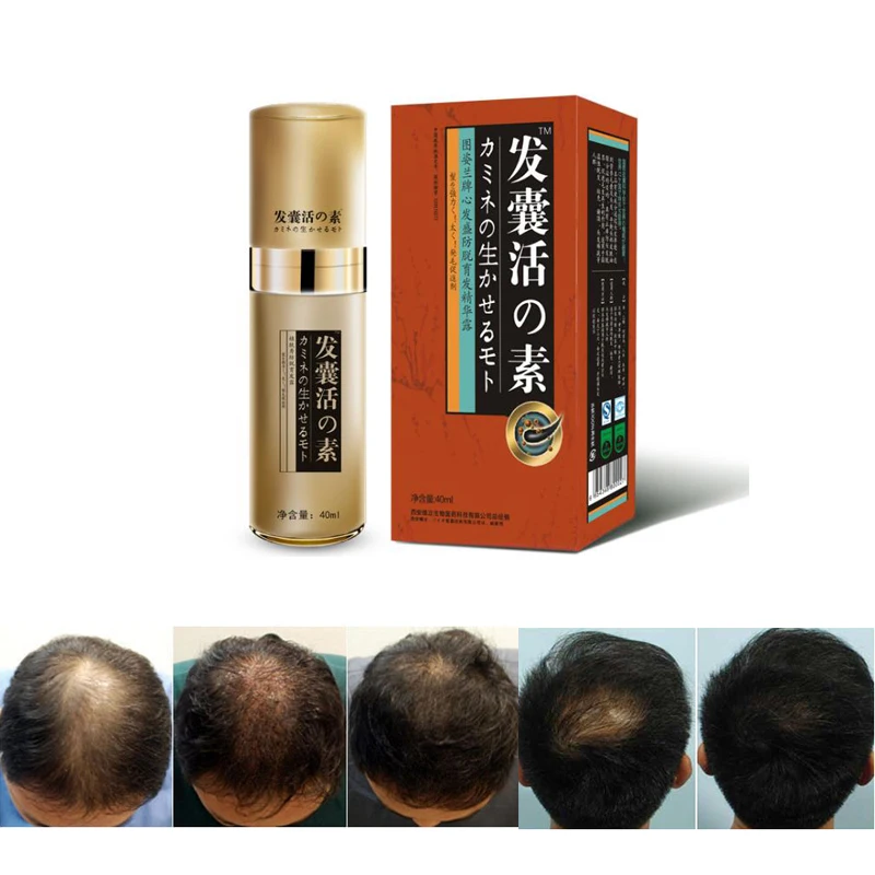 

3packs Best natural hair loss remedies fast hair growth oil yuda anti hair loss products peleda care bald Authentic Hair Growth