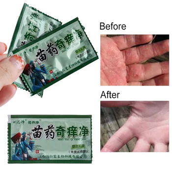 

1Bag Skin Care Health Products Patches Body Herbal Material Psoriasis Creams and Eczema Psoriasis Ointment