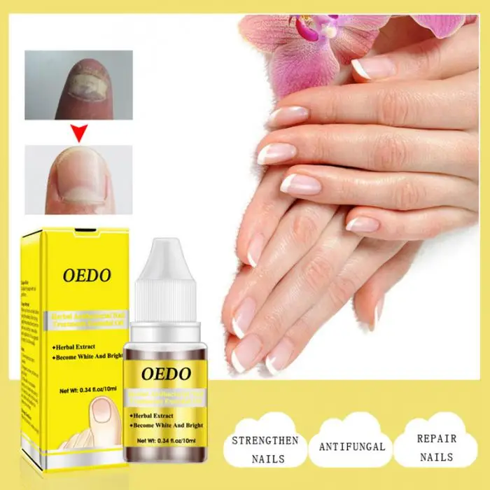 Женьшень антибактериальное лечение ногтей эфирное масло ногтей гриб ремонт уход за ногтями на ногах OA66