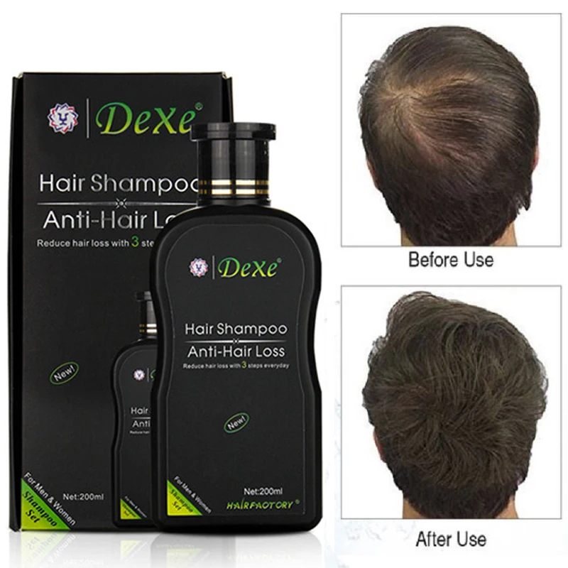 200ml Dexe Hair Shampoo Set Anti-hair Loss Chinese Herbal Hair Growth Tonic Thickener Hair Product for repair Treatment unsex