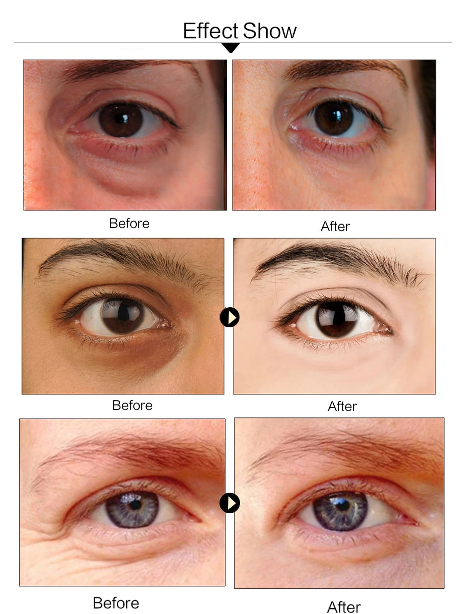 60pcs Eye Mask Gel Seaweed Collagen Eye Patches Under the Eye Bags Dark Circles Removal Moisturizing Eyes Pads Masks Skin Care