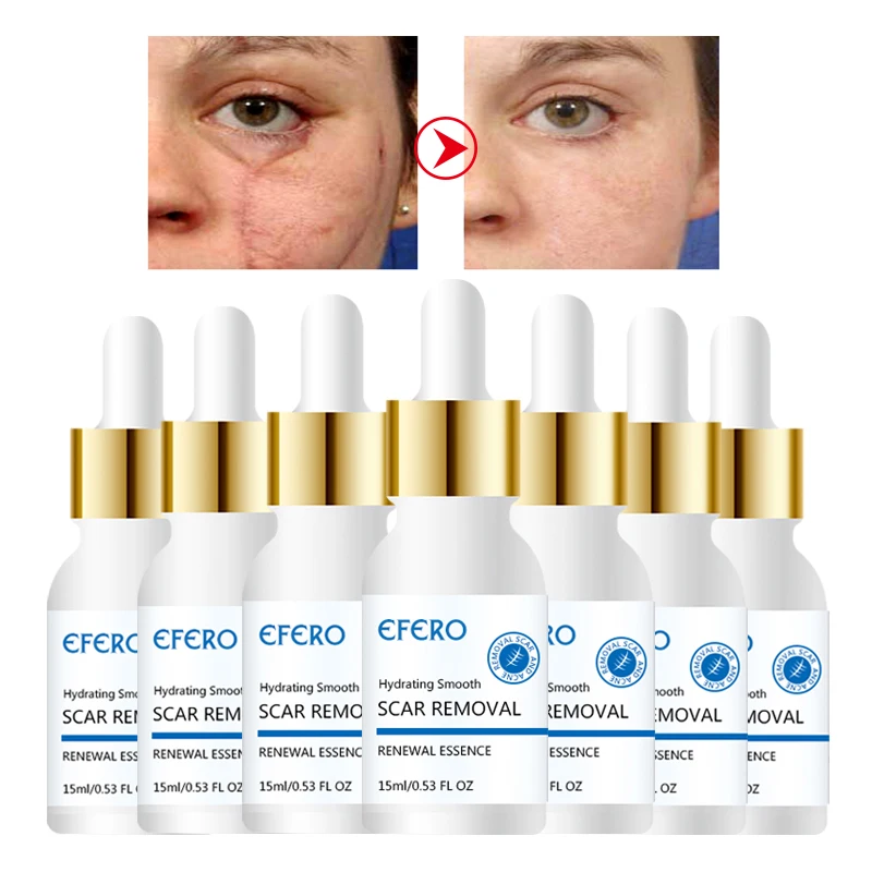 

Acne Scar Removal Cream Skin Repair Serum Spots Acne Treatment Blackhead Whitening Face Serum Anti Scar Stretch Marks Face Care