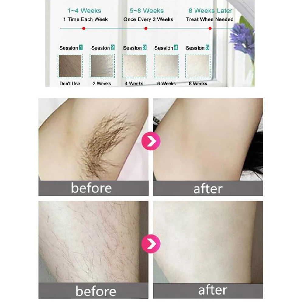 Personal Care IPL Permanent Hair Removal Tool Painless Hair Removing Beauty Machine Shaving Epilator Kits 500,000 Pulses Household Device for Whole Body