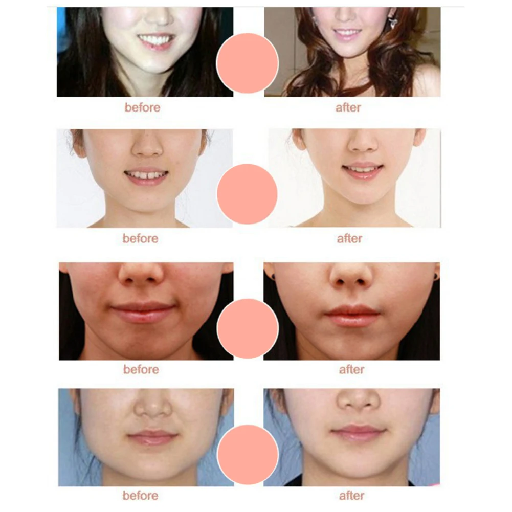 1pcs V Face Shape Tension Firming Mask