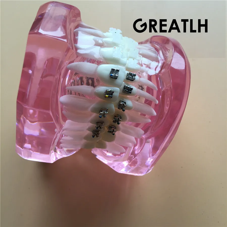 

Dental Orthodontic Model with Metal and Ceramic Brackets patient communication model teaching model