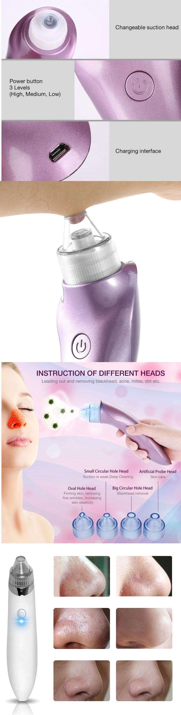 Vacuum Pore Cleaner Face Cleaning Blackhead Acne Removal Suction Black Spot Cleaner Facial Cleansing Cosmetology Face Machine5