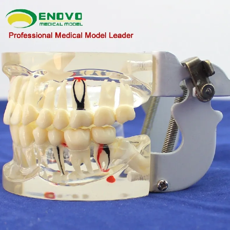 Прозрачная модель для взрослых, полная оральная патология, Стоматологическая модель, пародонтальное лечение, стоматологическая кариес, демонстрационная модель