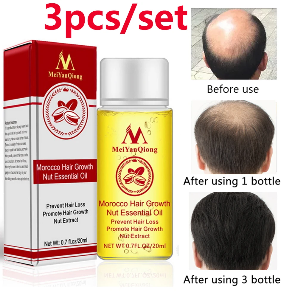 

Meiyanqiong 3pcs Hair Growth Essence Hair Loss Liquid Anti preventing Hair Loss alopecia Damaged Hair Repair Growing Faster