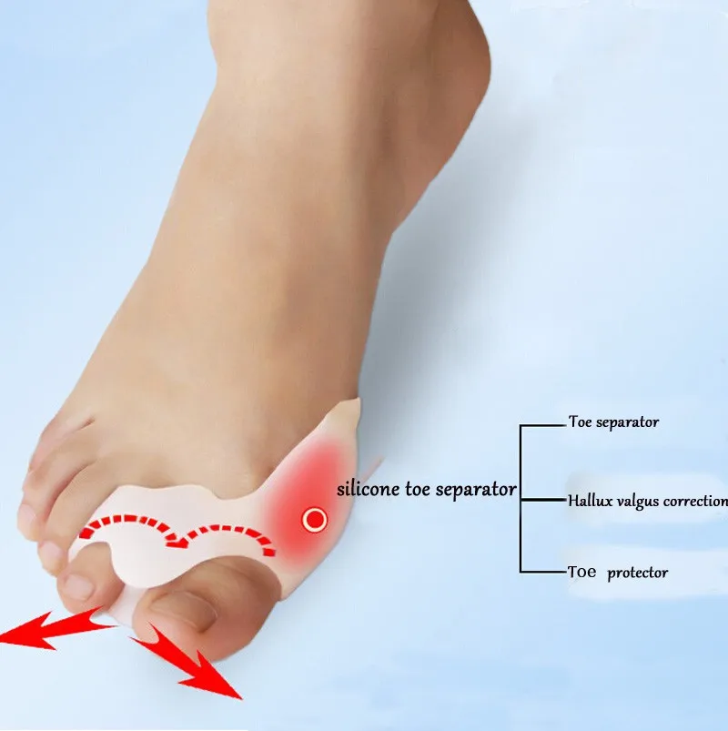 Bittb 2 пары силиконового геля Bunion корректор разделения ног ортопедический Hallux стопа с вальгусной деформацией инструмент для ухода за носками распорка