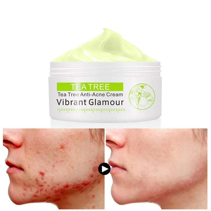 

New Tea Tree day creams face care treatment whitening cream skin care Acne Pimples Moisturizing Anti Winkles night cream