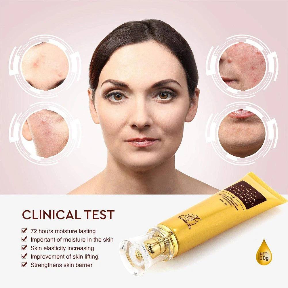 cream for pimple spots on face