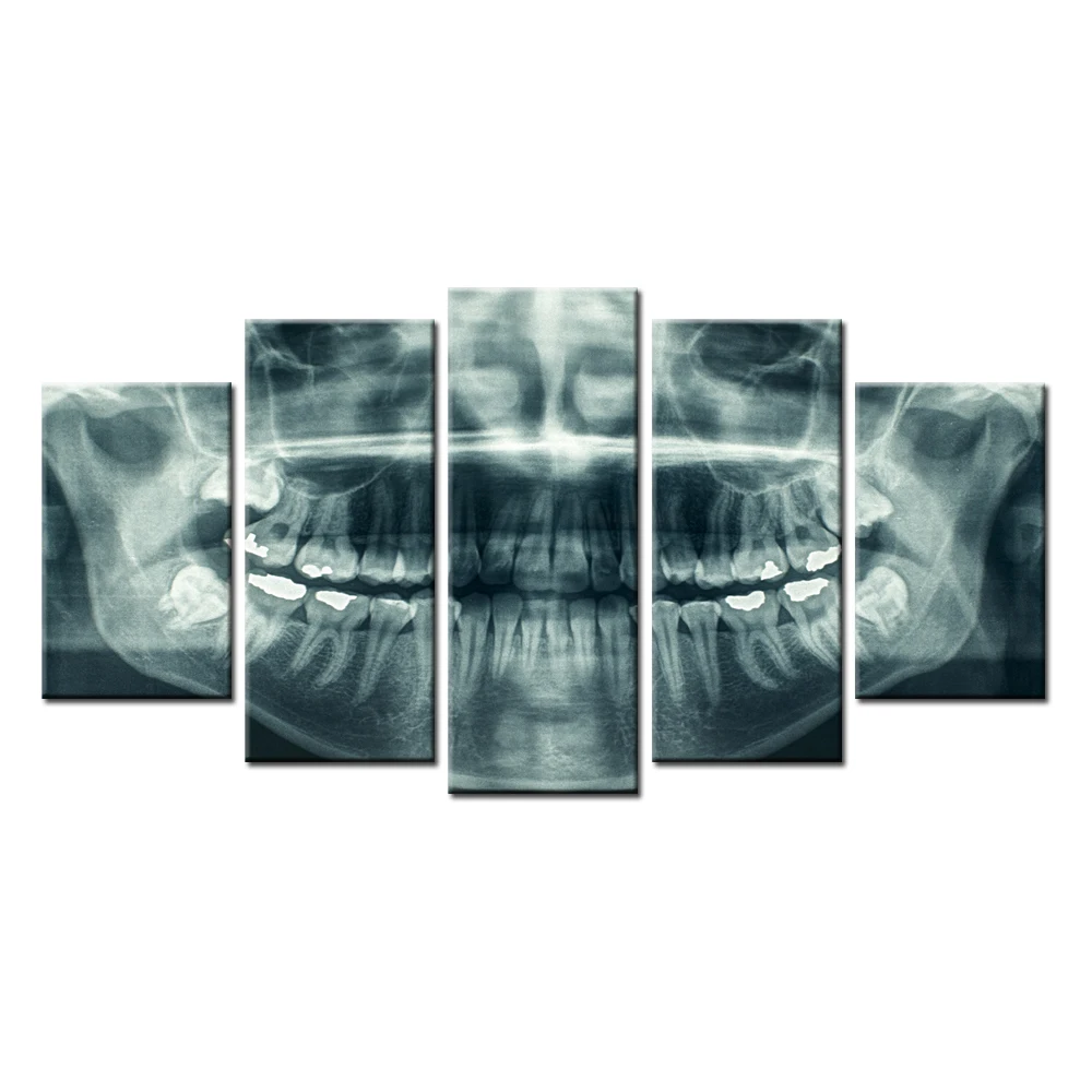 

HD Printed X-Ray Photography Mouth Canvas Prints Wall Poster Picture for LIving Room Free Shipping/SJM1714