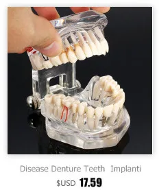 Болезни протезов зубов имплантации модель зубные лабораторное оборудование Гигиена полости рта зубные Инструменты Стоматолог Зубной