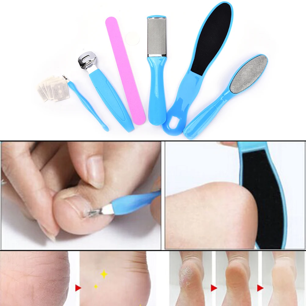 

Portable 10PCS Foot File Set Dead Hard Skin Callus Remover Cuticle Pusher Scraper Pedicure Foot Rasp Tools Foot Nail/Skin Care
