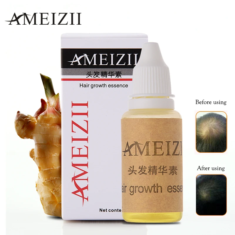 AMEIZII Hair Growth Essence Hair Loss Liquid 20ml dense hair fast sunburst hair growth grow Restoration pilatory