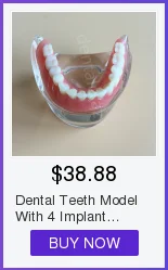 Dental dos Dentes da Doença do Implante com Ponte da Restauração Dentista do Dente para o Ensino de Alta Modelo Qualidade 29 Modelo dental dos dentes da doença do