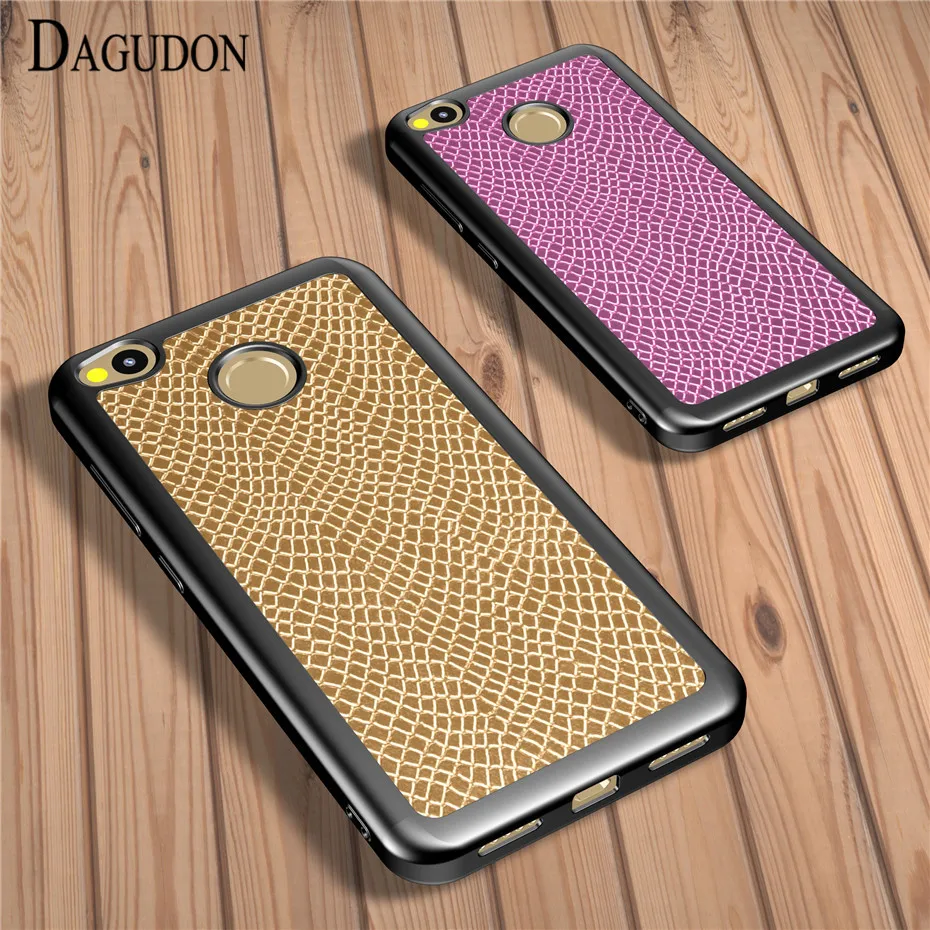 

DAGUDON Luxuy Animal Pattern TPU Cases For Xiaomi Redmi 4X Silicon Coque For Xiaomi redmi 4X Soft Cover Case Phone Shell fundas