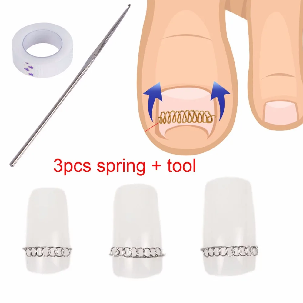 3 шт. пружина + инструмент для ремонта вросших ногтей|care tool|corrector footfoot nail care |