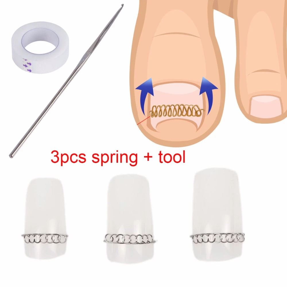 3pcs Spring+tool Ingrown Toenails Fixer Pedicure Recover Correction File  Spring Wire Corrector Foot Nail Care Tool - Foot Care Tool - AliExpress