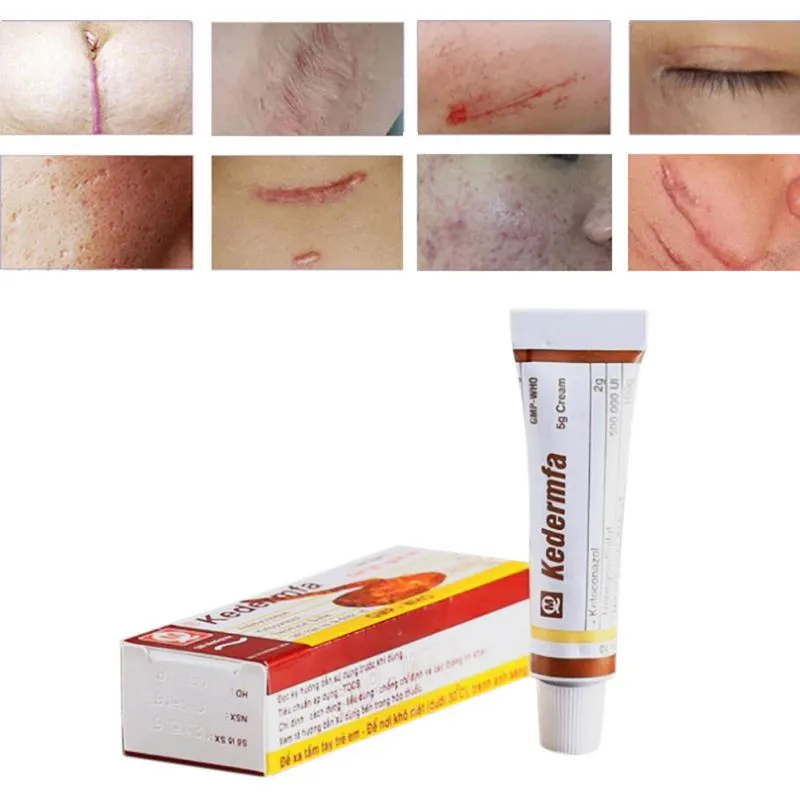 Vietnam-Snake-Oil-Remove-Scar-Cream-Women-Skin-Care-Female-Pigmentation-Corrector-Body-Face-Nourishing-Cream (2)