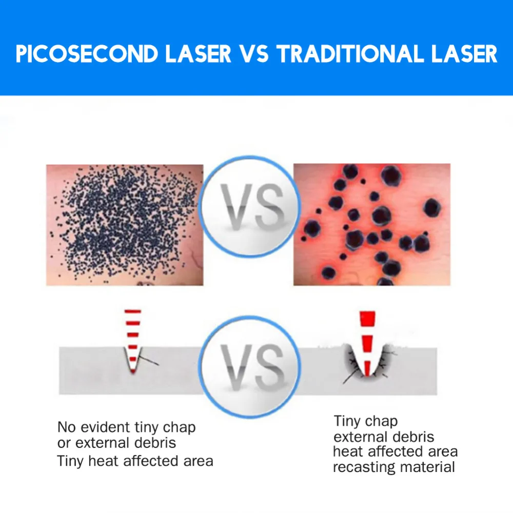США PlugPicosecond лазерная ручка красный синий светильник терапия тату шрам моль веснушки удаление темных пятен машина уход за кожей красота
