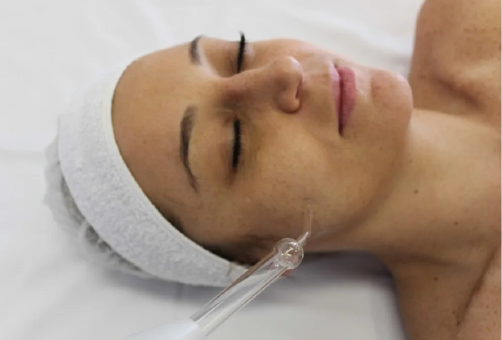 zoom-Aplicacao-Eletrodo-cauterizador-casa-da-estetica