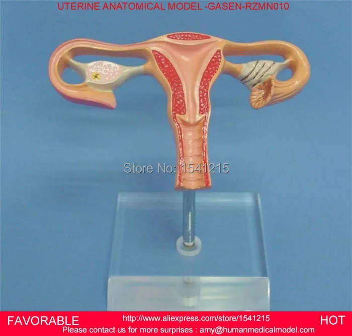 

THE PATHOLOGICAL MODEL OF THE UTERUS,UTERINE ANATOMY,GENITAL ORGAN DISSECT MODEL,LARGE UTERINE ANATOMY MODEL -GASEN-RZMN010