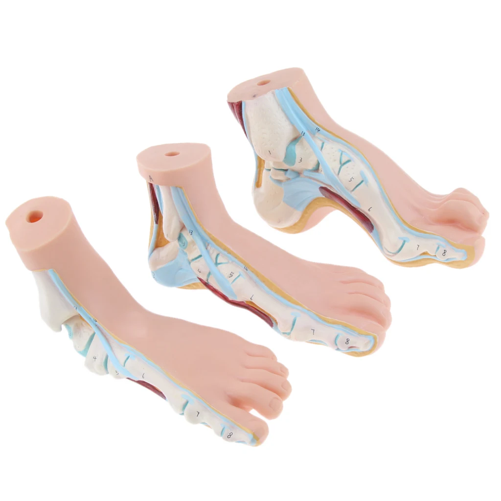 1:1 Life Size Human Foot Platypodia Bow Foot Anatomy Model Muscle Vascular