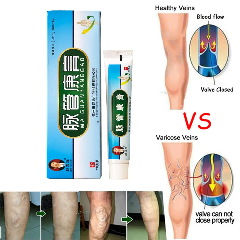

Varicose Veins ointment eins Varicose Treatment Plaster Foot Care Patch Vasculitis Natural Solution Herbal Patches New