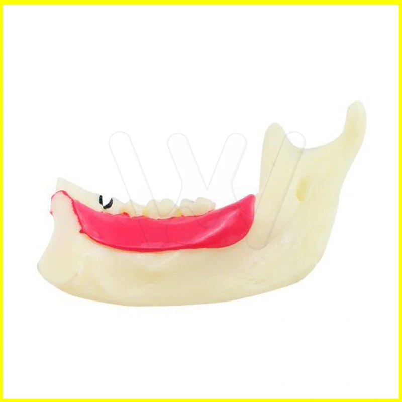 Dental MandibularTeeth Demonstration Anatomical Patient Study Teach Model (1)