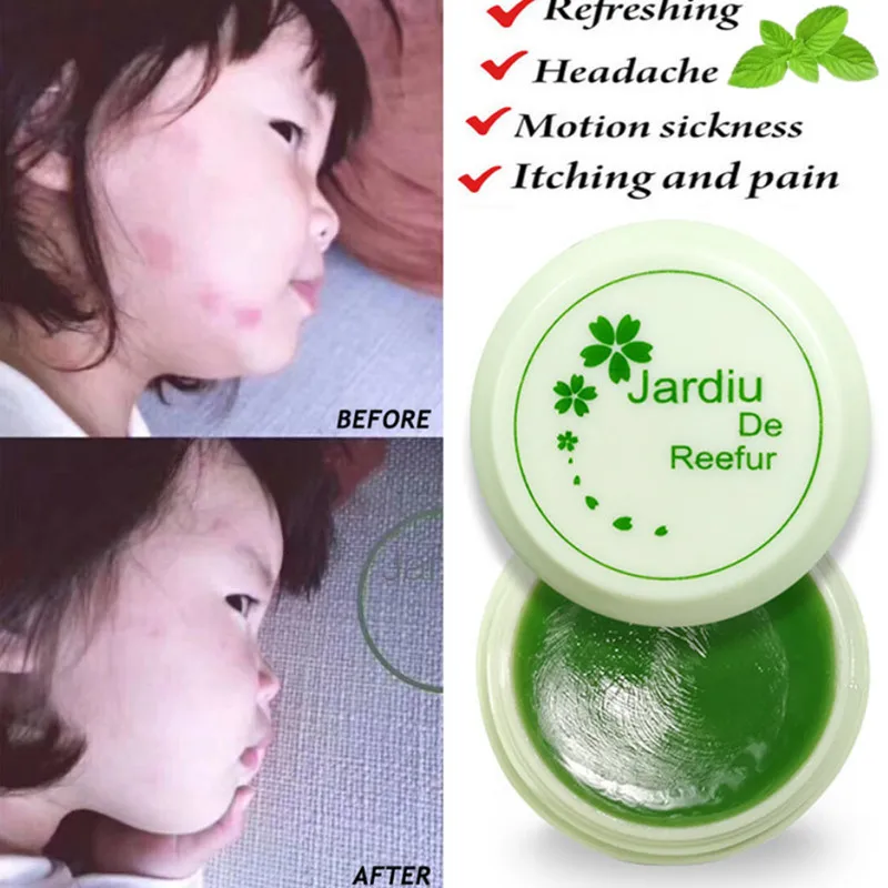 

Tiger Balm Herbal Green Ointment Mint Balm For Anti Mosquito Headache Relief Motion Sickness Dizziness Refreshing Essential Oil