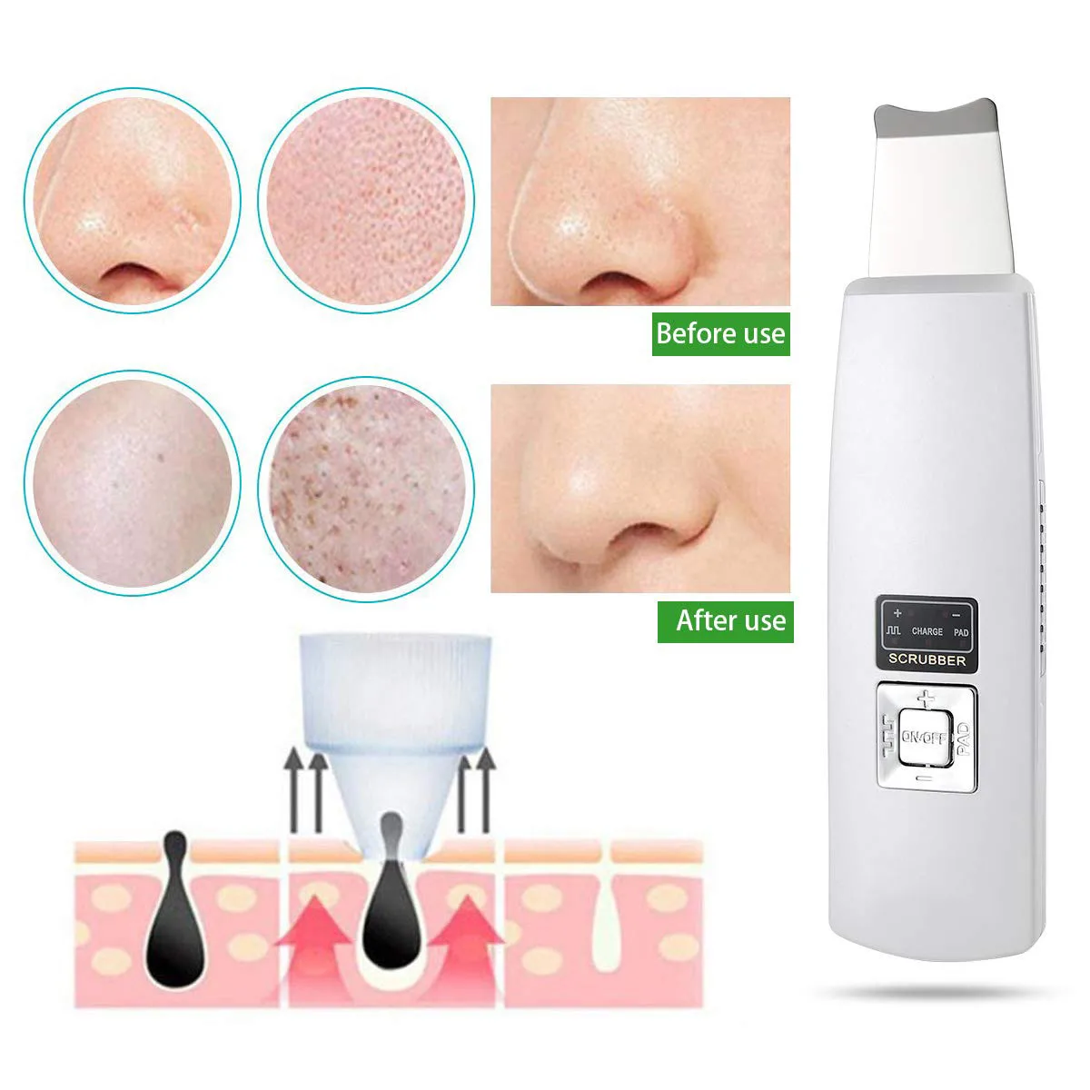  Rechargeable Ultrasonic Deep Face Cleaning Machine Skin Scrubber Remove Dirt Blackhead Reduce Wrink