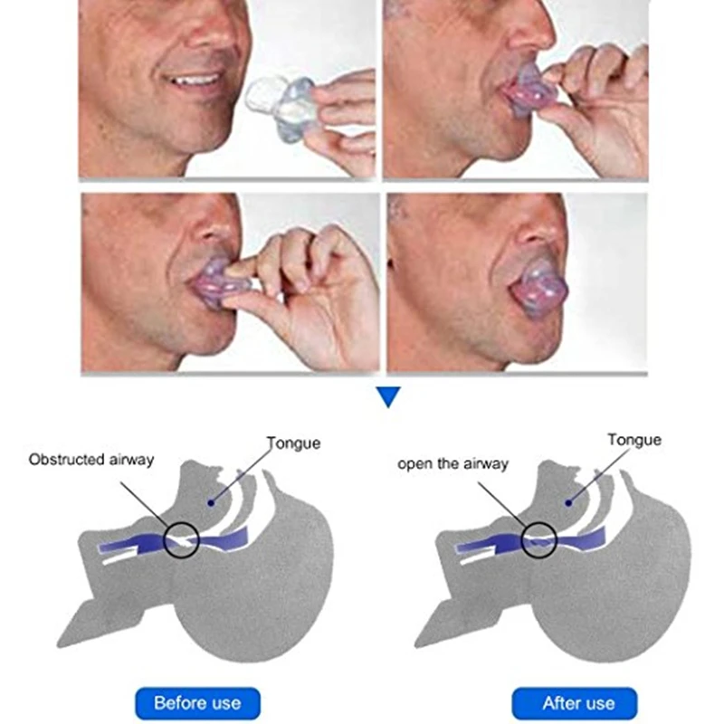 Anti Snore Tongue 