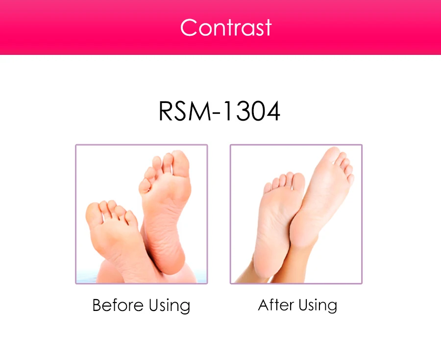 Dead Skin Removal