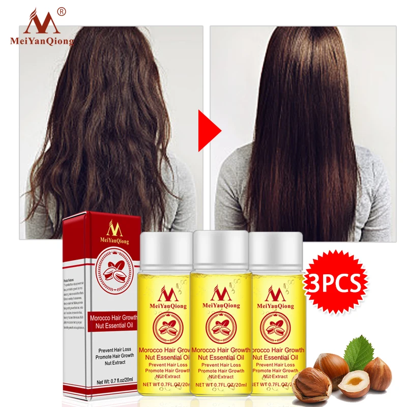 Morocco nuts Hair Fast Powerful Growth Essence 3PCS Preventing Hair Loss Baldness Liquid Oil Treatment Hair Care Product 20 ML Morocco nuts Hair Fast Powerful Growth Essence 3PCS Preventing Hair Loss Baldness Liquid Oil Treatment Hair Care Product 20 ML