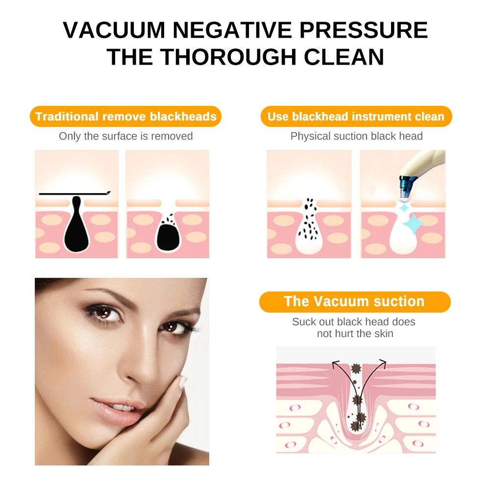 Многофункциональное электрическое очищение пор для лица, вакуумное удаление черных точек, очищающее средство от акне, инструмент для красоты, инструмент для ухода за кожей лица
