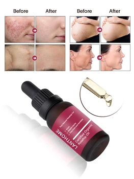 

1PC Rosehip Oil Moisturizing Essence Lighten Acne print Scars Stretch Mark Brightening Stretch Mark Dehydrated Ageing Skin TSLM2