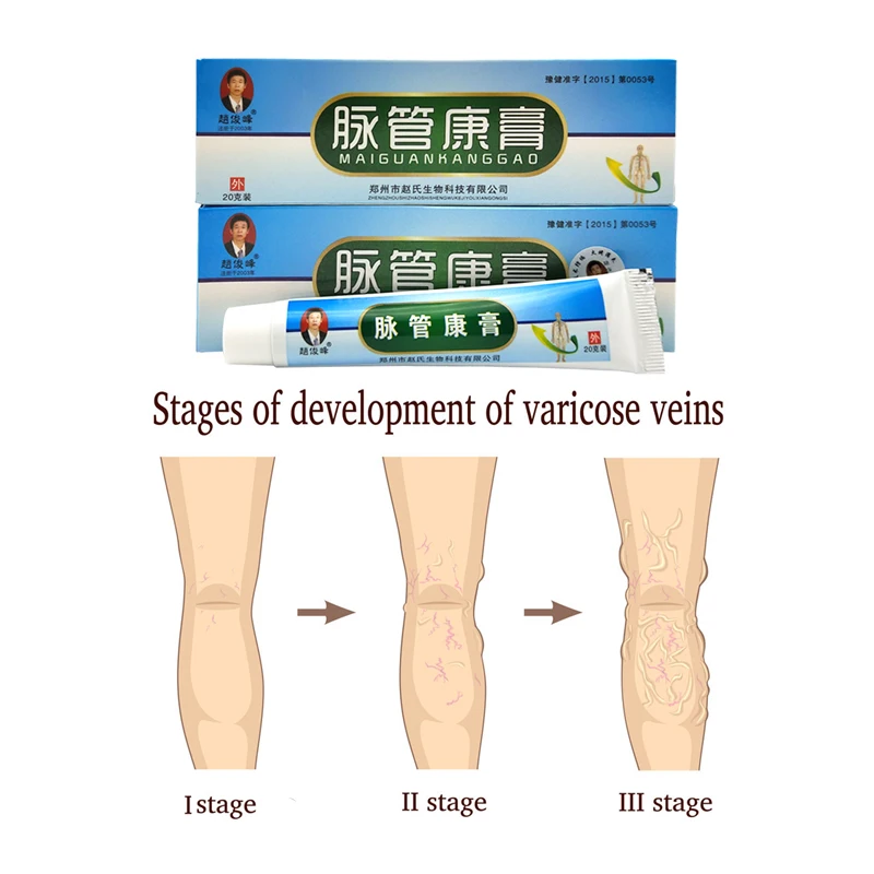 1 коробочка, Китайская натуральная травяная медицина для лечения варикозного расширения, сосудистых воздействий, массажный крем для лечения варикозного расширения вен, мазь