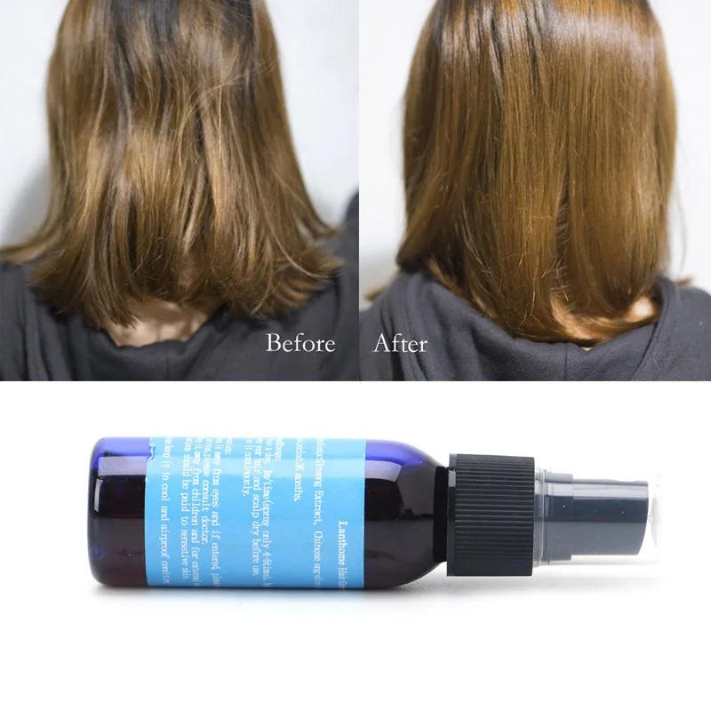 Hair Growth Liquid Spray Alopecia Pilatory Anti Hair Loss of Hair Regrowth 30ml