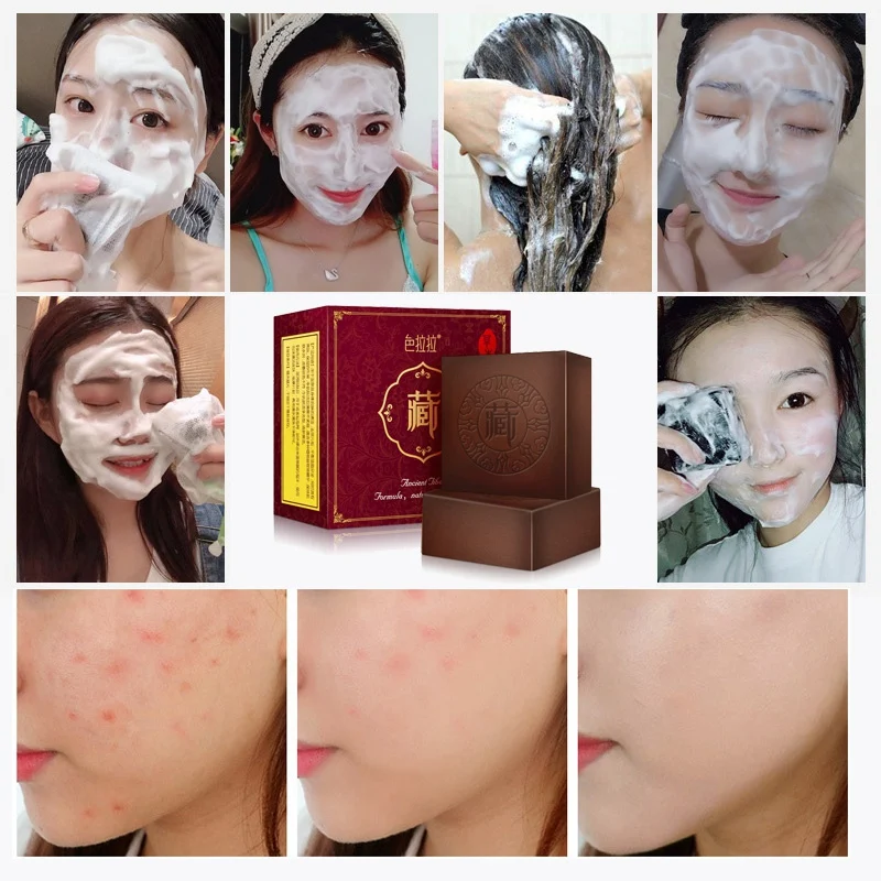 2019 Face Body Wash Soap Pimple Pores Blackhead Removal Treatment Oil Control Moisturizing 100g 2019 Face Body Wash Soap Pimple Pores Blackhead Removal Treatment Oil Control Moisturizing 100g