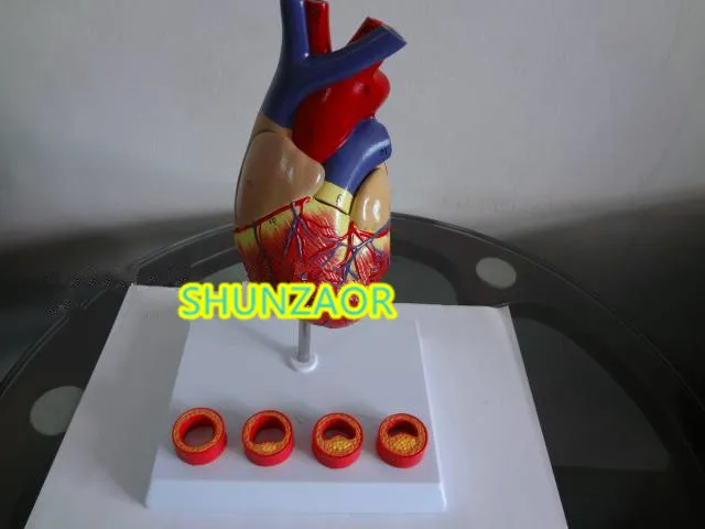 Атеросклероз пластиковая модель сердца человека для медицинского обучения