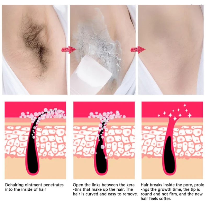 Mild No Stimulation 60g Hair Removal Cream 30g Repair Liquid Set For Men and Women Body Hand Leg Armpit Depilatory Cream