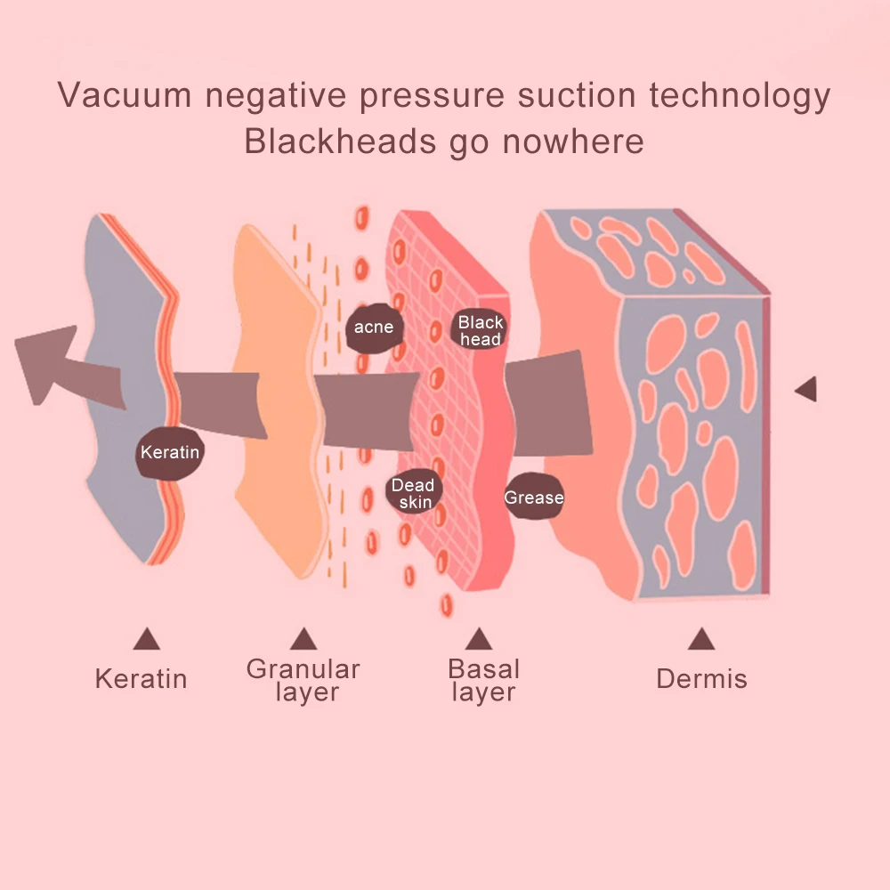 Средство для удаления черных точек и пятен, средство для удаления прыщей, вакуумный очиститель пор, инструменты для ухода за кожей лица